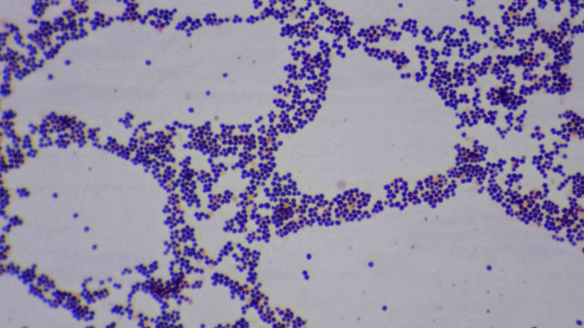 Staphlococcus Aureus on gram stain